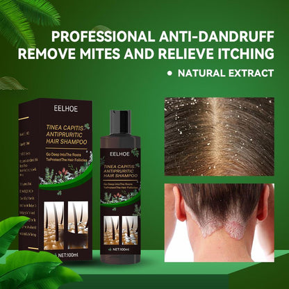 EELHOE Anti-Dandruff Shampoo - Itch Relief, Hair Loss Prevention, Oil Control & Refreshing Care