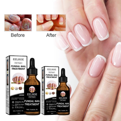 EELHOE Nail Repair Liquid Thickening, Brightening, Whitening, Repairing, Moisturizing, And Nourishing Nail Care Liquid